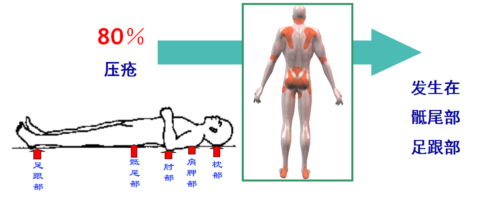 防褥瘡床墊 防褥瘡床墊