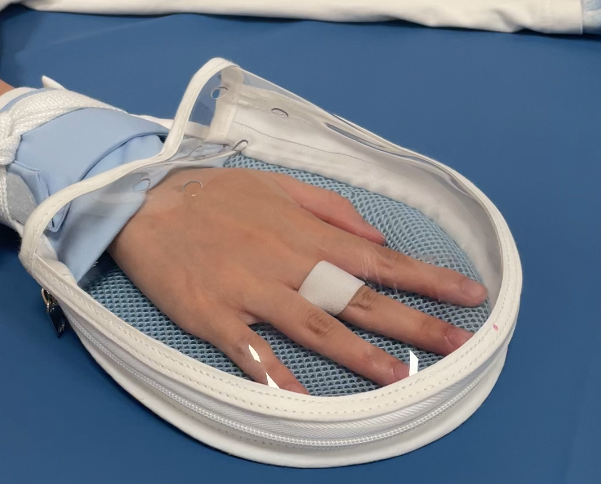 蒙泰轉(zhuǎn)化護(hù)士創(chuàng)新的“透明型”約束手套